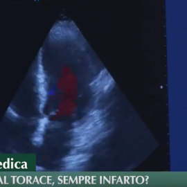Dolore al torace, sempre infarto?