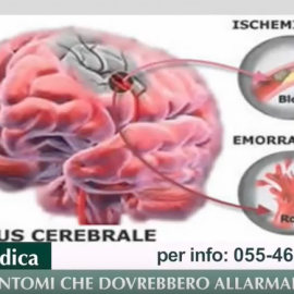 Riconoscere l’Ictus